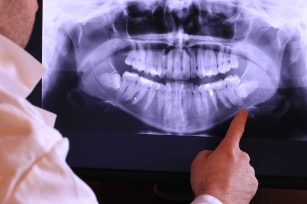 Best Emergency Denture Repair in Cortland, NY