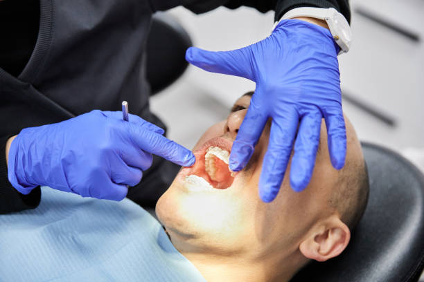 Best Emergency Dental Care for Sports Injuries in Cortland, NY